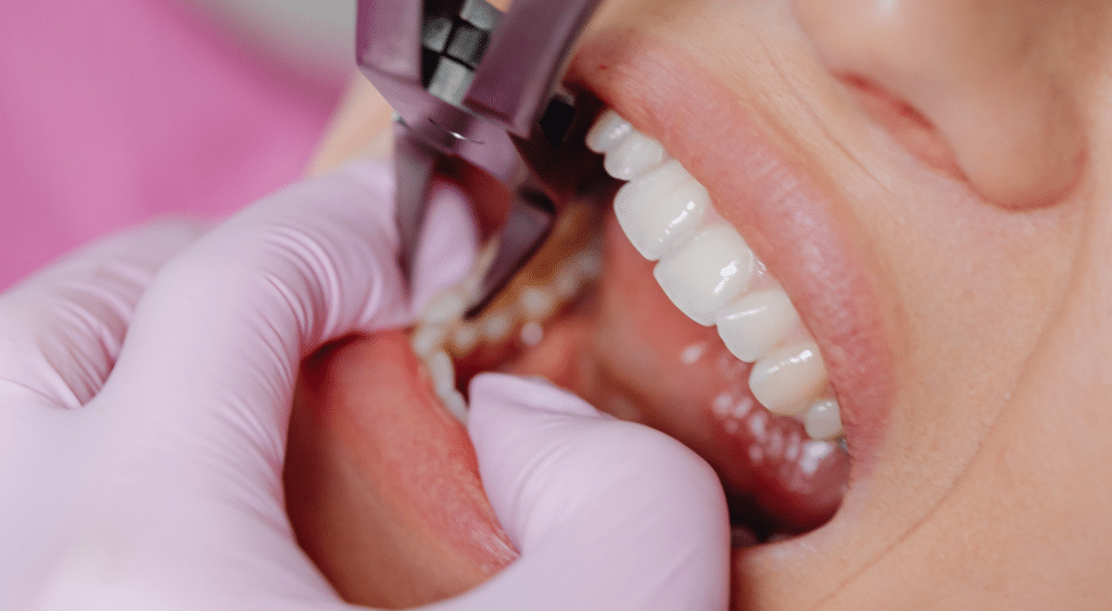 L&rsquo;extraction dentaire à Paris Dental Studios