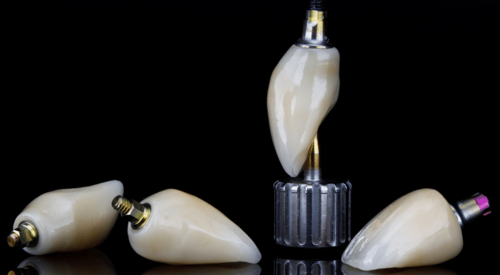Couronnes sur implants dentaires