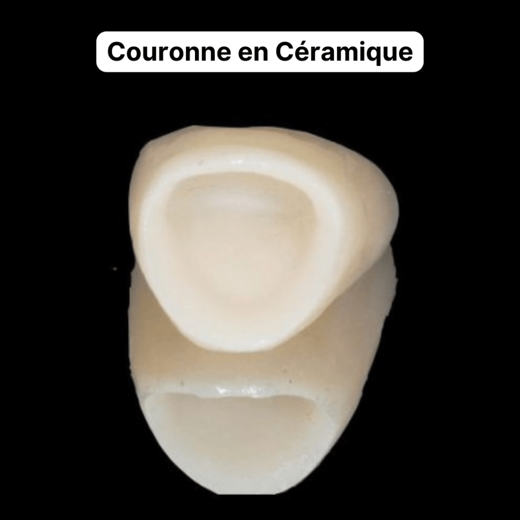 Transformation du sourire : des résultats impressionnants