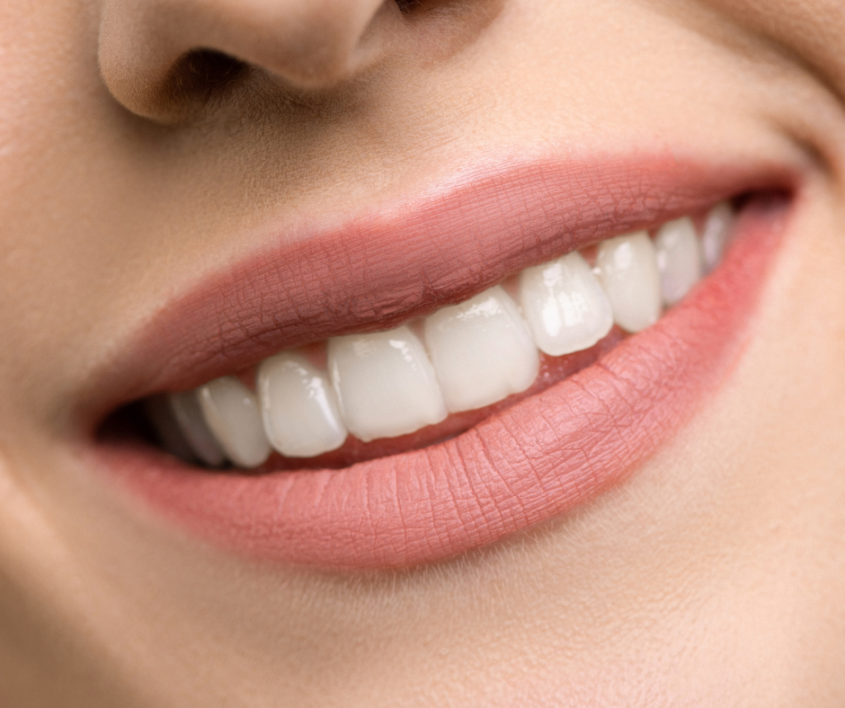 Comment avoir les dents blanches : conseils du dentiste